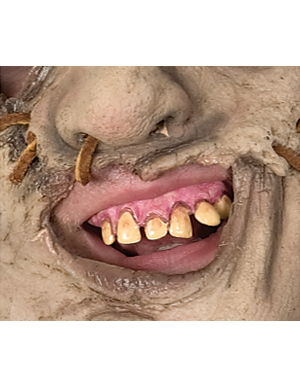 The Texas Chainsaw Massacre Leatherface prosthetic teeth costume accessory for adults.